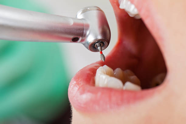 Best Emergency Treatment for Toothache in Terrell Hills, TX